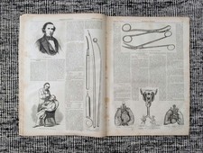 1859 Dr. Horace Green Medical Instruments, Throat Anatomy, Royal Youths — Feb 5 picture