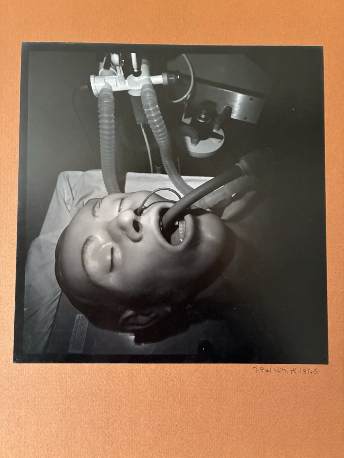 Medical Patient Surrealism Neal White Signed 1974 Vintage Silver Gelatin Photo 
