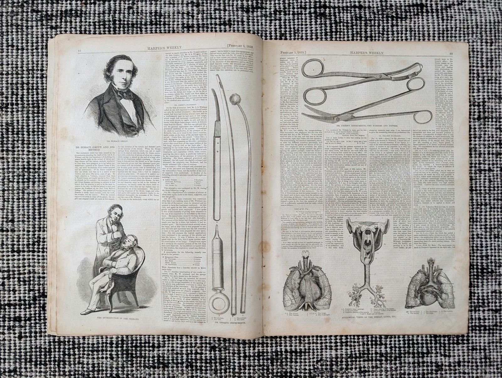 1859 Dr. Horace Green Medical Instruments, Throat Anatomy, Royal Youths — Feb 5