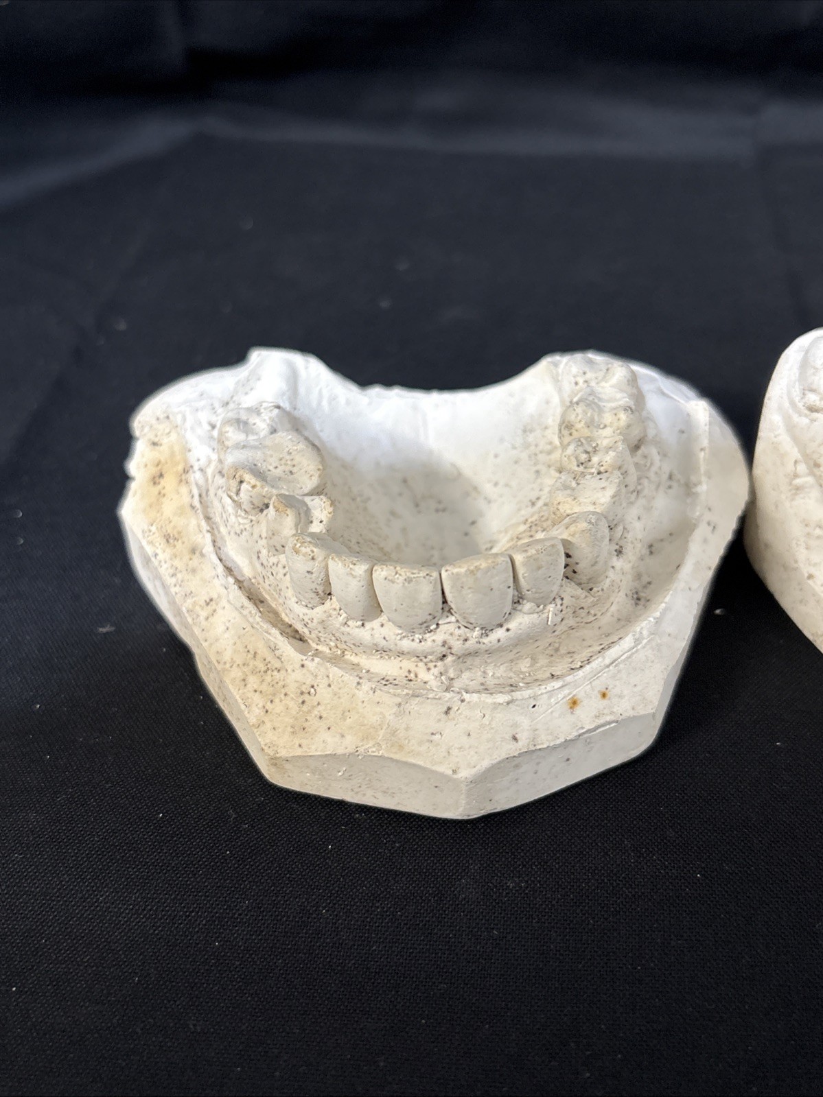 Weird Vintage 1970’s Molded Teeth Impressions Molded For Dentures.
