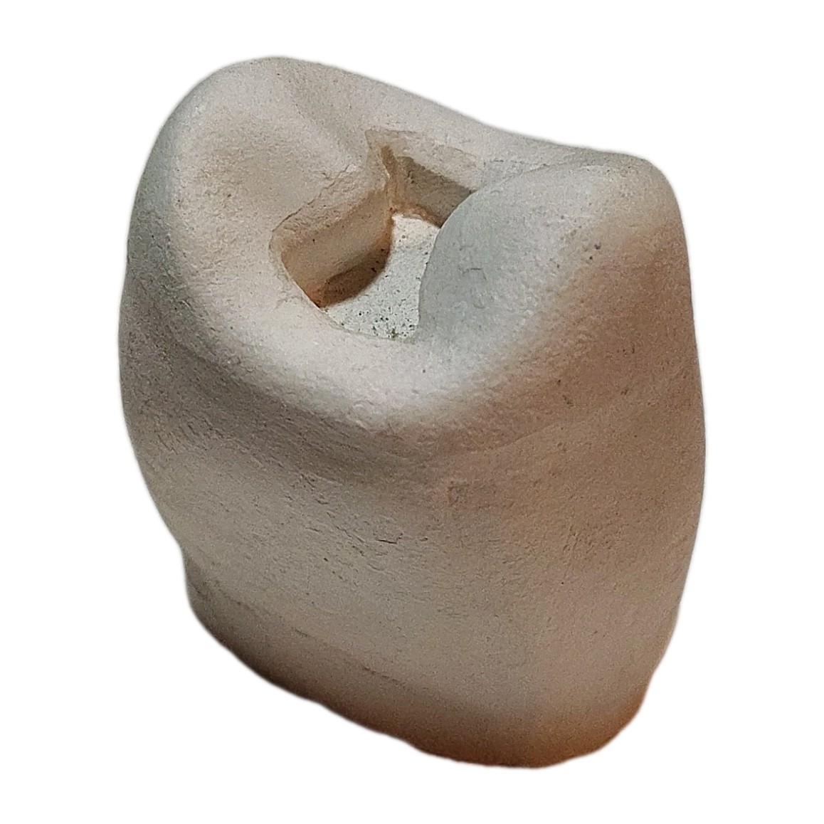 Vintage Large Chalkware Tooth Dentist Medical Oddity Dental Strange 2\
